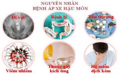 Nguyên nhân bị áp xe hậu môn