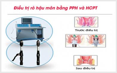 Thuốc Đông y điều trị rò hậu môn dứt điểm không?