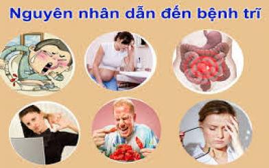 Nguyên nhân và cách điều trị bệnh trĩ ngoại