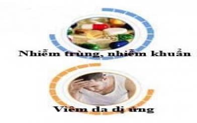 Cảnh báo biến chứng ngứa rát hậu môn