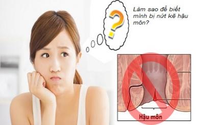 Những dấu hiệu nứt kẽ hậu môn dễ nhận biết nhất