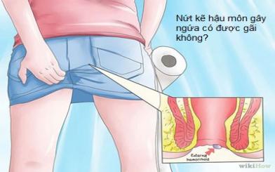 Nứt kẽ hậu môn gây ngứa có được gãi hay không