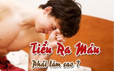 Tiểu ra máu khám ở đâu nhanh chóng và hiệu quả?
