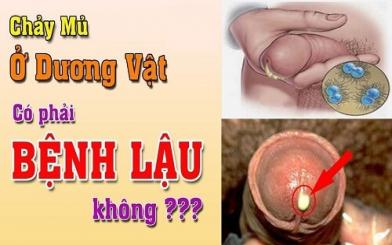 Dương vật chảy mủ là dấu hiệu của bệnh gì?