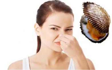 Khí hư ra nhiều có mùi hôi – Dấu hiệu của bệnh gì?