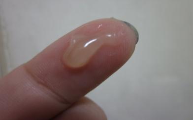 Tinh trùng màu vàng là bệnh gì? Nguyên nhân và cách điều trị