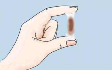 Khí hư màu nâu giữa kỳ kinh – Cảnh báo ung thư cổ tử cung