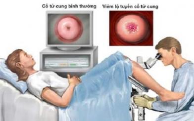 6 bác sĩ chữa viêm lộ tuyến giỏi được phái đẹp tin tưởng