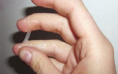 Khí hư ra nhiều bất thường: Nhận biết bệnh lý qua triệu chứng