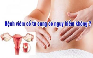 Viêm cổ tử cung có nguy hiểm không? Cách điều trị hiệu quả