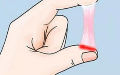 Huyết trắng có máu là bệnh gì? Cách chữa hiệu quả theo nguyên nhân