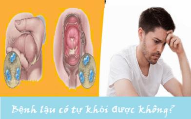 Bệnh lậu có tự khỏi được không? Có chữa khỏi triệt để không?