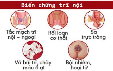 5 biến chứng trĩ nội và cách điều trị triệt để búi trĩ