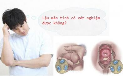 Lậu mãn tính có xét nghiệm được không? Chữa được không?