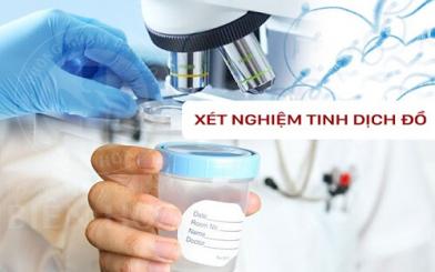 Xét nghiệm tinh dịch đồ: Quy trình, chi phí, địa chỉ thực hiện