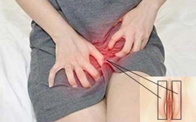 [ Lý giải thắc mắc ] Ngứa môi lớn vùng kín là dấu hiệu bệnh gì và chữa như nào ?