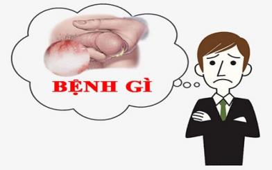 Tiểu buốt ra dịch mủ ở dương vật cảnh báo bệnh gì?