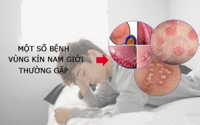Các bệnh về cậu nhỏ phổ biến nhất hiện nay [Tổng hợp]