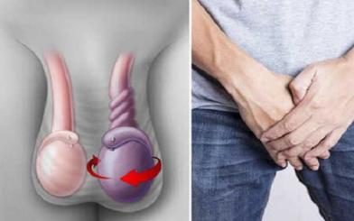 Nhức tinh hoàn: Nguyên nhân, triệu chứng, cách điều trị