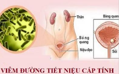 Viêm đường tiết niệu cấp ở nữ [Tổng hợp kiến thức chi tiết]