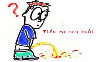 Tiểu ra máu buốt [Nguyên nhân, bệnh lý,..., cách chữa]
