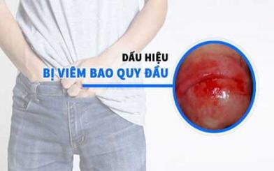  8 triệu chứng viêm bao quy đầu và cách điều trị
