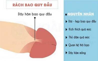 Rách da bao quy đầu: Mức độ nguy hiểm và cách điều trị