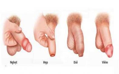 Biểu hiện thường thấy khi mắc các bệnh về bao quy đầu