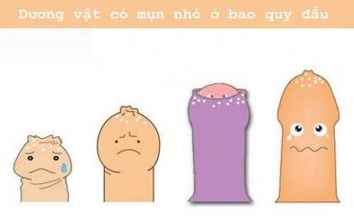Dương vật có mụn nhỏ ở bao quy đầu: Nguyên nhân, cách điều trị