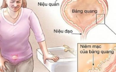 [Giải đáp] Tại sao lại bị viêm bàng quang?