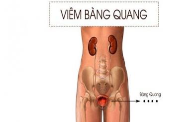 Viêm bàng quang điều trị bao lâu thì khỏi hoàn toàn?