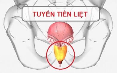 Tác hại bệnh tuyến tiền liệt và cách chữa tại nhà