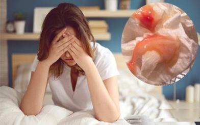 [ Khí hư có máu ] Nguyên nhân, dấu hiệu và cách điều trị hiệu quả