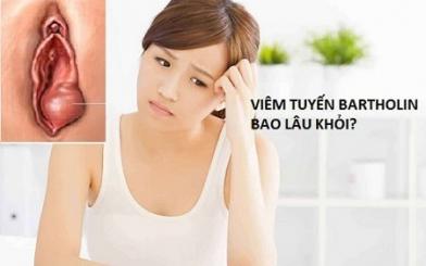 [ Giải Đáp ] Viêm tuyến Bartholin bao lâu thì khỏi có tự khỏi hay không ?