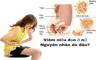 [ Review ] Hình ảnh viêm niệu đạo ở nữ giới chi tiết và đầy đủ nhất