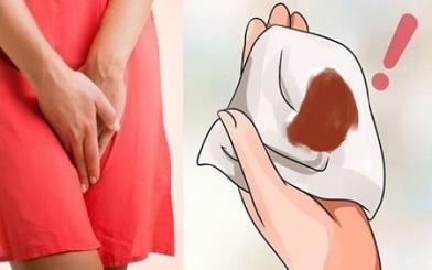 [ Giải Đáp ] Phá thai ra máu nâu có sao không và nguyên nhân do đâu ?