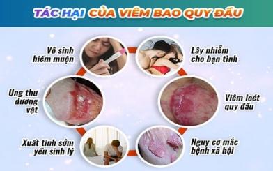 [ Giải Đáp ] Viêm bao quy đầu bao lâu thì hết và chữa bằng cách nào ?