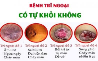Bệnh trĩ ngoại có tự hết không ? Chữa bằng cách nào hiệu quả ?