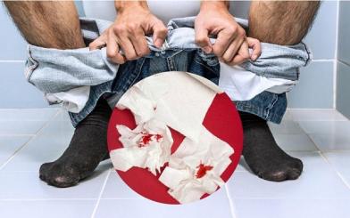 Bị trĩ nội đi ra máu có nguy hiểm không và chữa như nào ?