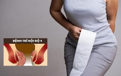 Trĩ nội độ 4 : Nguyên nhân, triệu chứng và cách điều trị hiệu quả