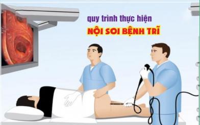Nội soi bệnh trĩ là gì và dùng phương pháp nào hiện đại ?