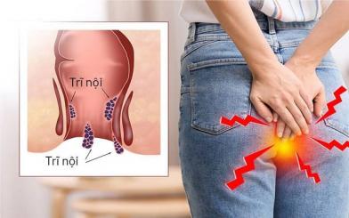 Trĩ nội xung huyết là do đâu ? Nguyên nhân, triệu chứng và cách chữa hiệu quả ?
