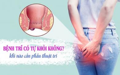 Trĩ nội có tự hết không ? giải đáp chi tiết từ chuyên gia
