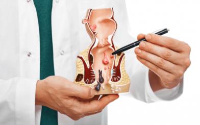 Nội soi trĩ có đau không ? Những thông tin cần biết trước khi thực hiện