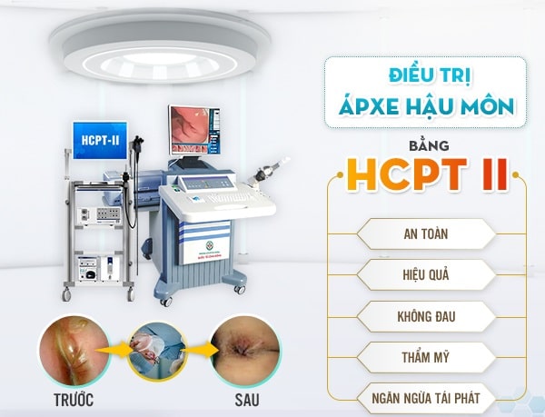 Nên điều trị áp xe hậu môn ở đâu tại Hà Nội?