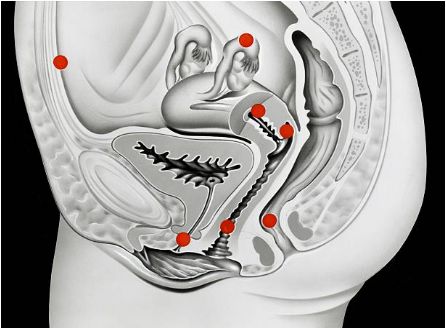 áp xe hậu môn trực tràng có nguy hiểm không