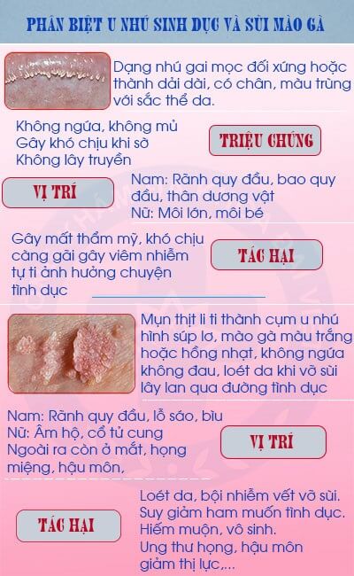Dấu hiệu nhận biết nhú gai sinh dục ở nam và nữ giới