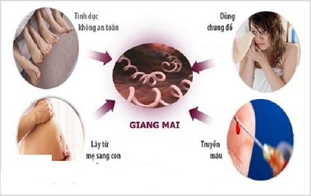 Bệnh giang mai lây qua những con đường nào ?