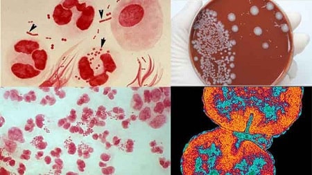 Biện pháp y khoa giúp phát hiện và điều trị bệnh lậu hiệu quả