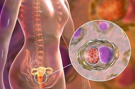 Thực tế về việc bệnh lậu có lây lan qua con đường ăn uống không?